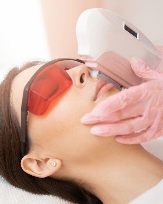 Laser Treatment